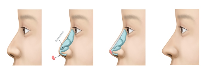 Function of the Nose