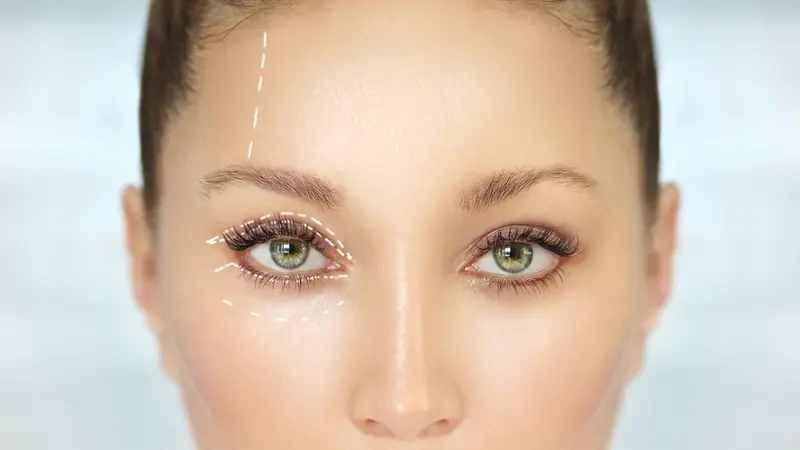 Upper Blepharoplasty Indications