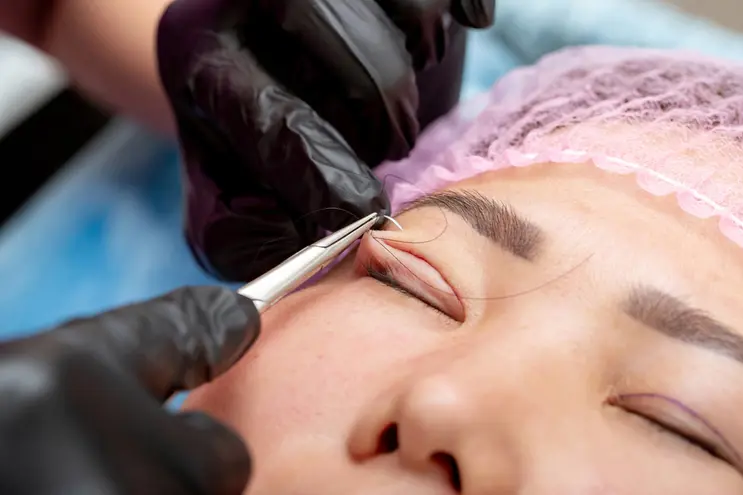 Preparing for Ptosis Correction 